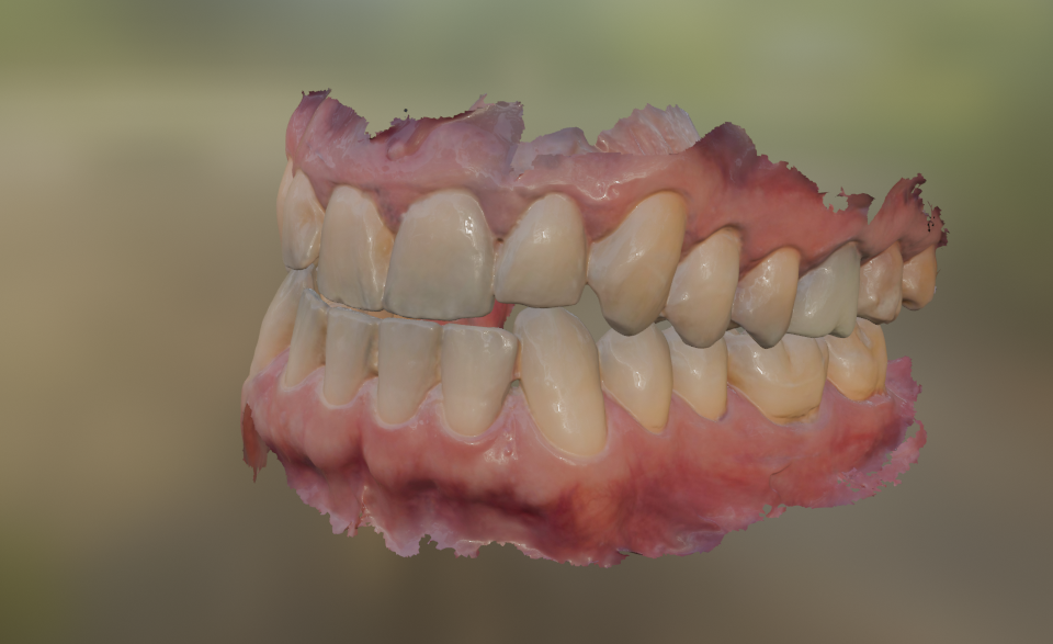 Full teeth
